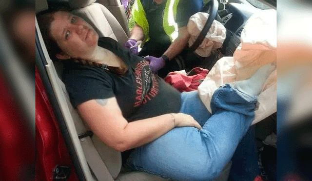 Mujer sufre terrible fractura en accidente por poner sus pies sobre el tablero de auto [FOTOS]