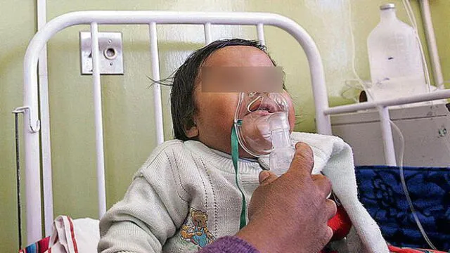 25 personas mueren de neumonía grave en Piura