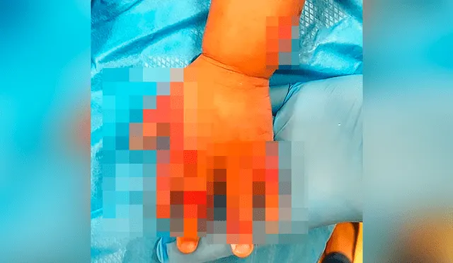 Empleada quema con agua hirviendo el brazo de bebé que cuidaba [VIDEO]