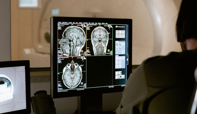 Resonancias magnéticas a cerebros de personas con migraña revelan señales claves vinculadas a la enfermedad. Foto: referencial / University of Utah