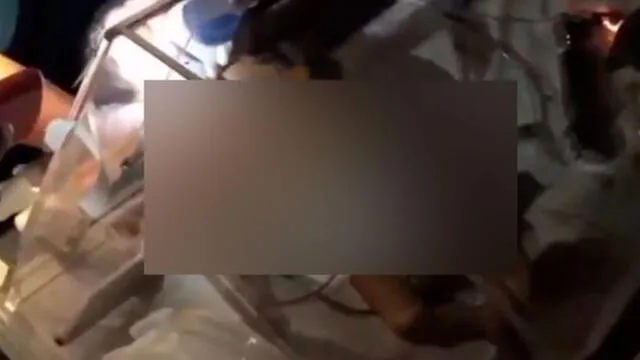 Médicos suministran respiración de forma manual a recién nacido por apagón en Venezuela [VIDEO]