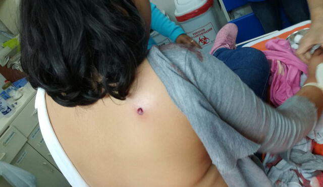 Niña recibe un disparo en el hombro tras un tiroteo cerca de su casa en el Callao
