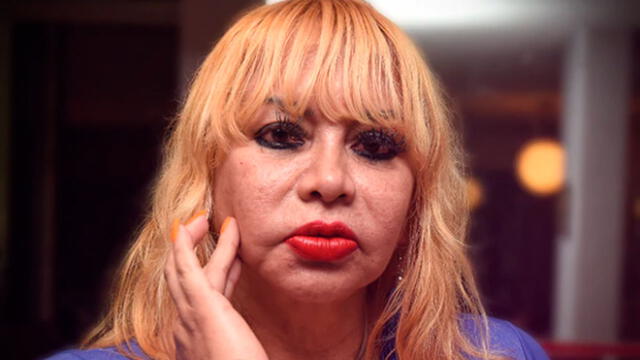 La periodista Lourdes Sacín denunció nuevamente a Andy V por violencia física y psicológica. Foto: En exclusiva