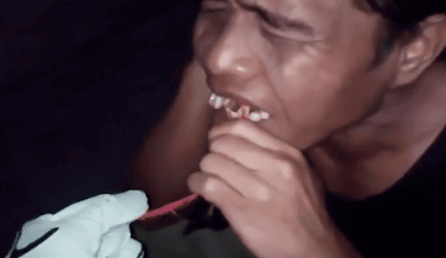 Facebook viral: joven pide a sus amigos que le extraigan el diente de insólita forma [VIDEO]