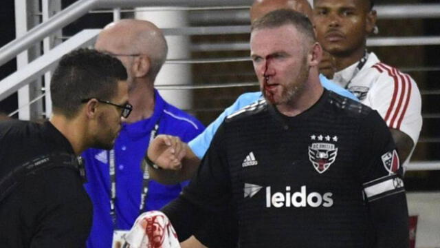 Wayne Rooney sufrió la fractura de su nariz en un partido de la MLS | VIDEO