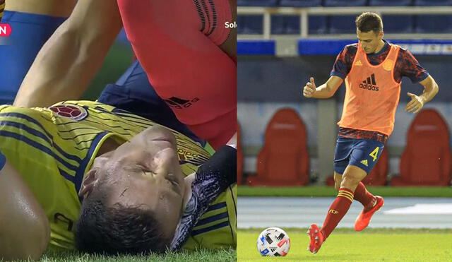 El parte médico determinó que Arias sufrió una luxo-fractura del tobillo izquierdo. Composición: Captura de TV (Movistar)/Twitter Selección Colombia