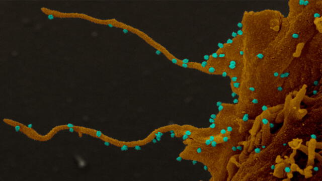 Imagen microscópica de las céluas renales de un mono africano infectado con SARS-CoV-2. Foto: NIH