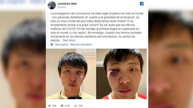“No quiero tu coronavirus en mi país”: joven asiático sufre brutal golpiza en Inglaterra [FOTO]