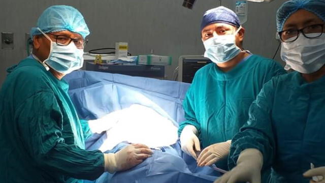 Huacho: salvan a mujer de 65 años tras compleja operación del pulmón