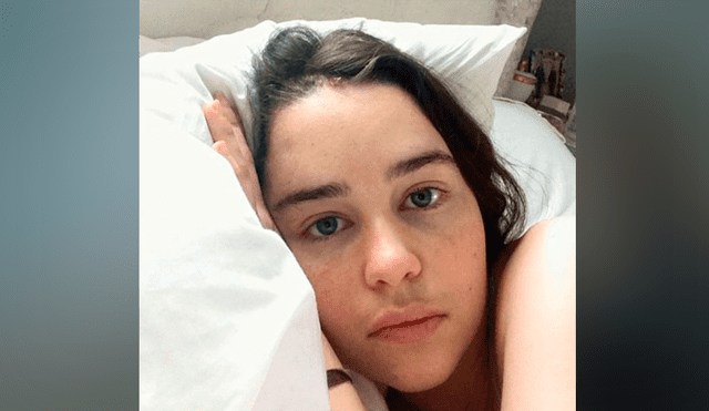 Emilia Clarke comparte fotos de su postoperación por aneurisma cerebral