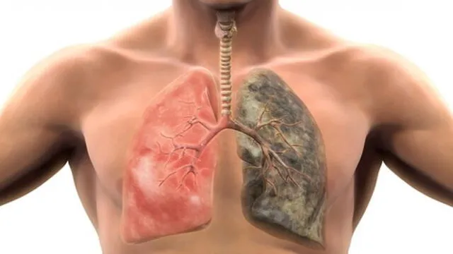 Nueva terapia personalizada ayudará a pacientes con cáncer de pulmón