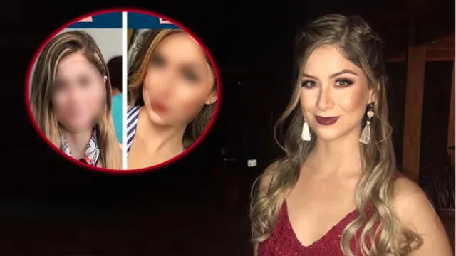 En Instagram, Doménica Delgado se hizo cirugía y su "nueva" apariencia sorprende