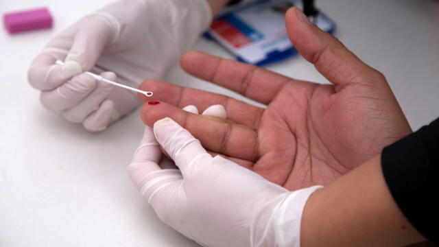 Prueba de VIH. Foto: AFP