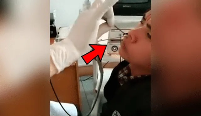 Facebook viral: misteriosa criatura que resistía abandonar nariz de joven provoca espanto [VIDEO]