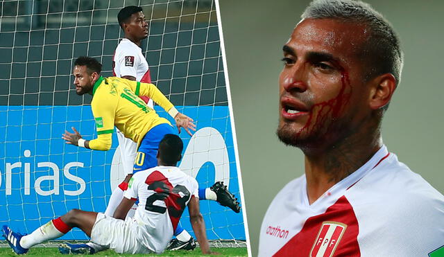 Miguel Trauco recibió un duro golpe en la ceja en el Perú vs. Brasil. Fotos: AFP