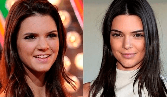 Kendall Jenner, antes y después de cirugías.