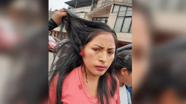 El Agustino: mujer mordió y arrancó la oreja a estudiante durante pelea en avenida [VIDEO]