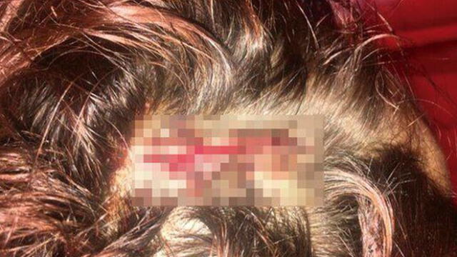 Detienen a hombre que atacó a joven con un hacha: estaba “harto” del Día de la Mujer