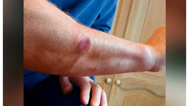Su dueño también fue atacado por los canes, dejándole una profunda herida en el brazo (Captura: The Sun)