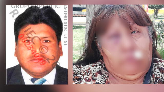 Sujeto atacó a palazos y ladrillazos a su suegra en Tacna