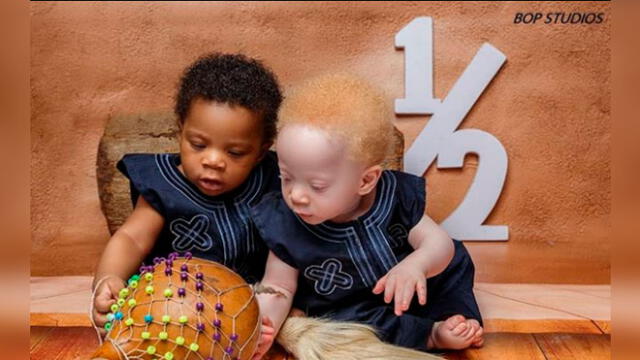 Bebés mellizos con diferente color de piel y cabello sorprenden al mundo [FOTOS]