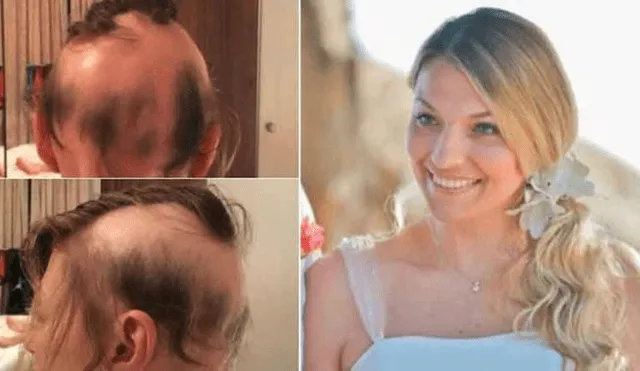 Facebook viral: novia pierde el 90 % de su cabello por el estrés de su boda y así termina [FOTOS] 