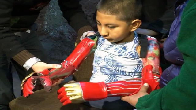 Niño cusqueño recibió prótesis de brazos elaboradas con impresión 3D