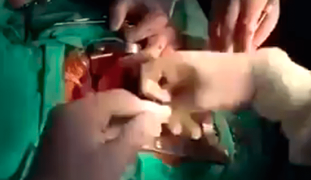 Twitter: la increíble reacción de médicos sorprendidos por sismo durante operación a corazón abierto [VIDEO]