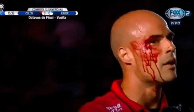 Jugador de Colón terminó grave y sangrando en encuentro contra Junior [VIDEO]