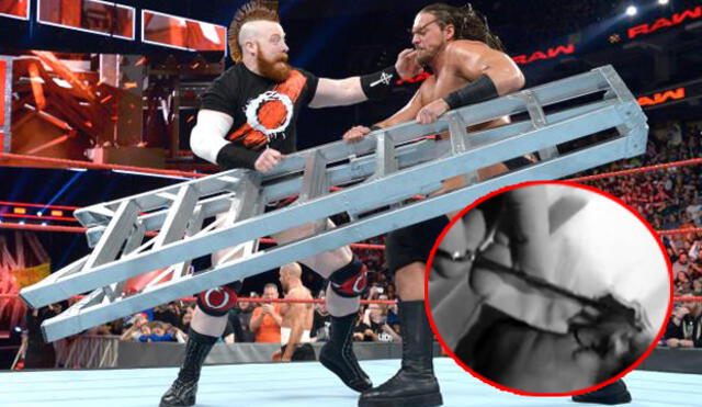WWE: Sheamus casi pierde un ojo durante pelea y es duda para WrestleMania 33 [VIDEO]