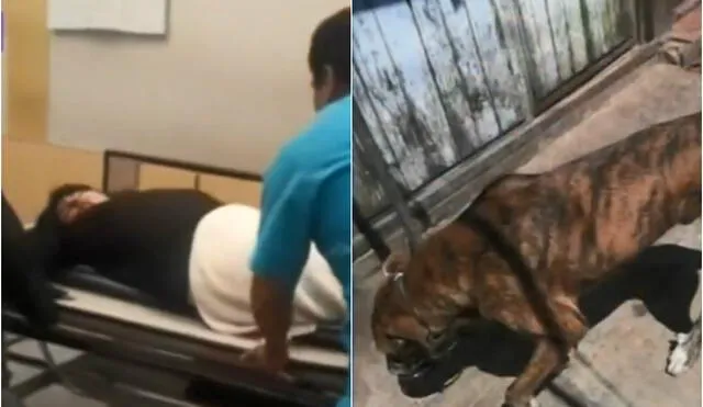 Cusco: Joven queda al borde de perder una pierna tras ser mordida por un perro [VIDEO]