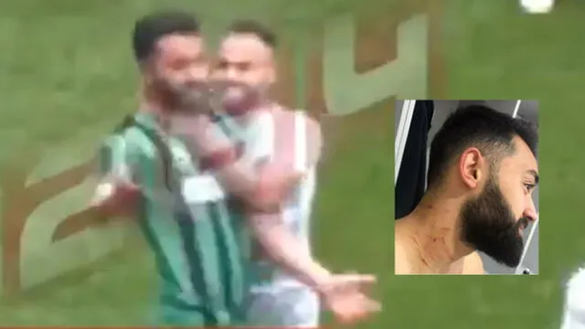 Turquía: Jugador estuvo en el campo con una cuchilla y agredió a varios rivales [VIDEO] 