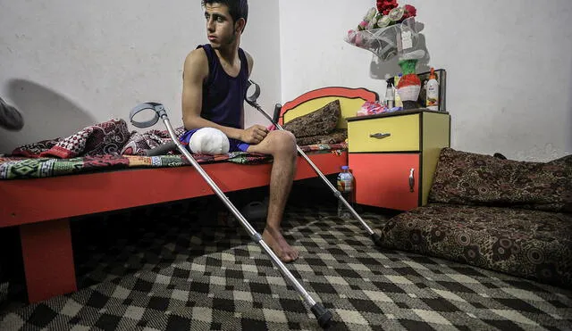 Jóvenes quedan amputados en Gaza