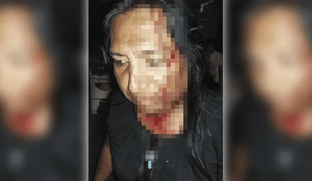 Sujeto ataca brutalmente a activista LGTBI