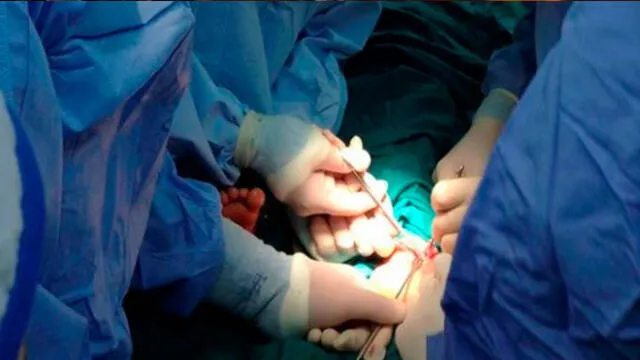 Inglaterra: cirujano admite que grabó sus iniciales en el hígado de sus pacientes