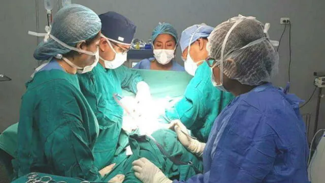 Huacho: extirpan tumor gigante de paciente en Hospital Regional