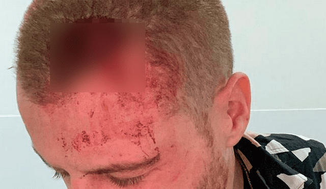 Hombre sufrió ataque homofóbico tras besar a otro sujeto en un bar
