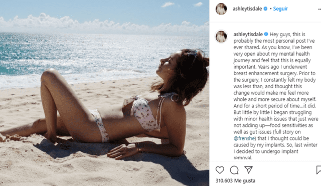 Ashley Tisdale reveló en Instagram que se quitó los implantes de senos porque le ocasionaron problemas de salud