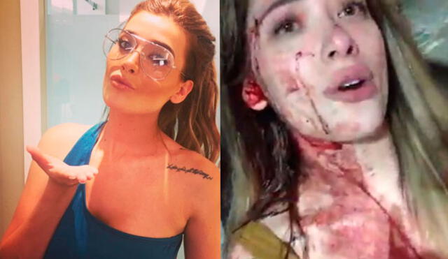 Facebook: Chica de reality mexicano denuncia brutal golpiza en una discoteca [VIDEOS]
