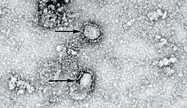 Coronavirus. Crédito: Instituto de Microbiología de la Academia de Ciencias de China.