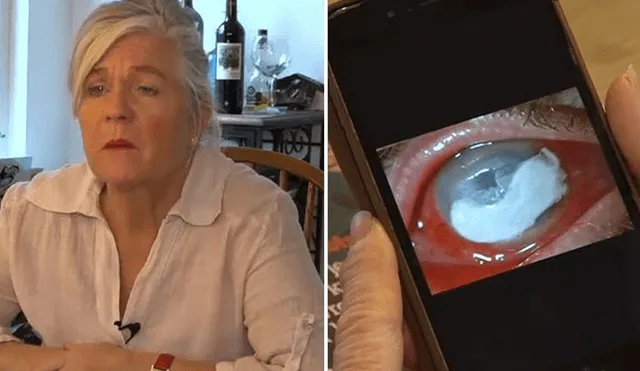 Mujer perdió un ojo por una ameba que contrajo mientras se duchaba 