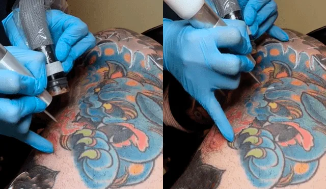Facebook viral: joven intenta quitarse tatuaje del brazo, sin imaginar el terrible resultado que tendría