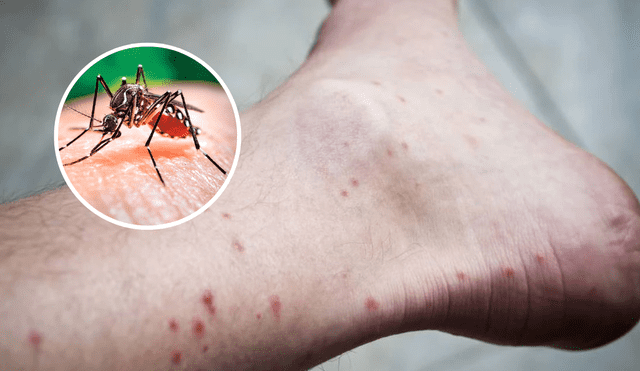 Los mosquitos suelen elegir a sus víctimas por el olor que estas desprenden. Foto: composición LR/AFP