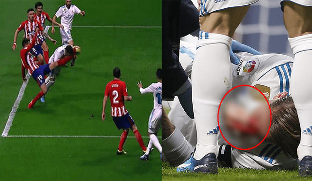 Real Madrid: así quedó la nariz de Sergio Ramos tras la patada que sufrió [FOTOS]