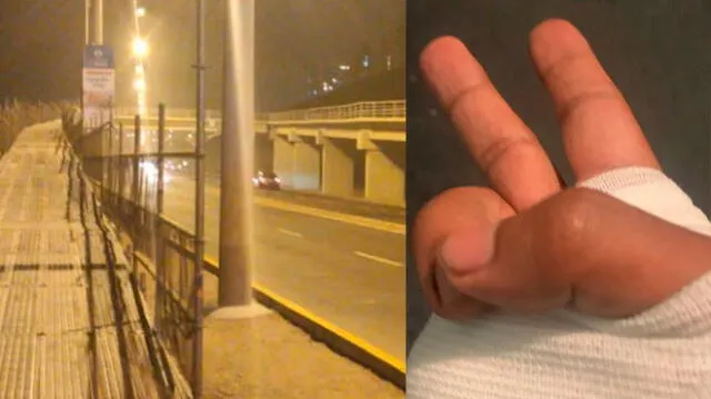 Ciclista que perdió un dedo mientras circulaba por puente provisional de San Miguel pidió a las autoridades que coloquen carteles para advertir los riesgos de la obra. Créditos: Facebook.