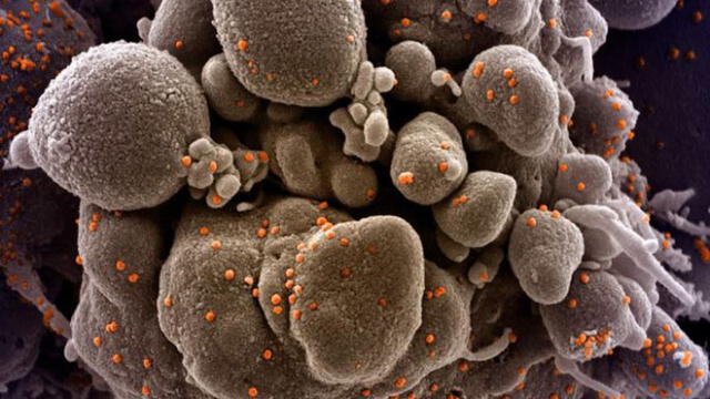 Impactantes imágenes del coronavirus atacando células humanas