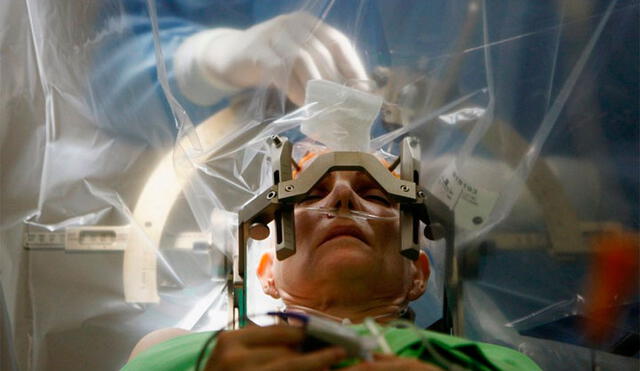Las muestras vivas de cerebro son obtenidas de pacientes que se someten a neurocirugías para tratar la epilepsia o tumores. Foto referencial: Sinirbilim.