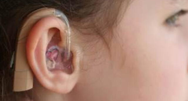 Rotary Club entregará mil audífonos a niños con problemas auditivos en Arequipa