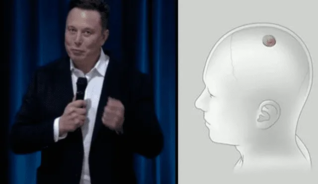 Elon Musk durante la presentación de los chips desarrollados por Neuralink. Foto: Captura: Neuralink Update