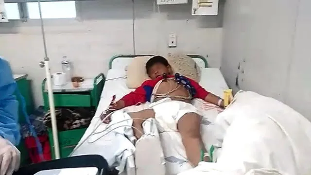 Cusco: piden ayuda para menor que se fracturó pierna en yunsa [VIDEO]